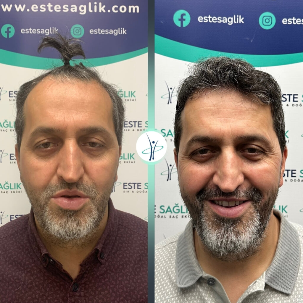 Este Sağlık 1