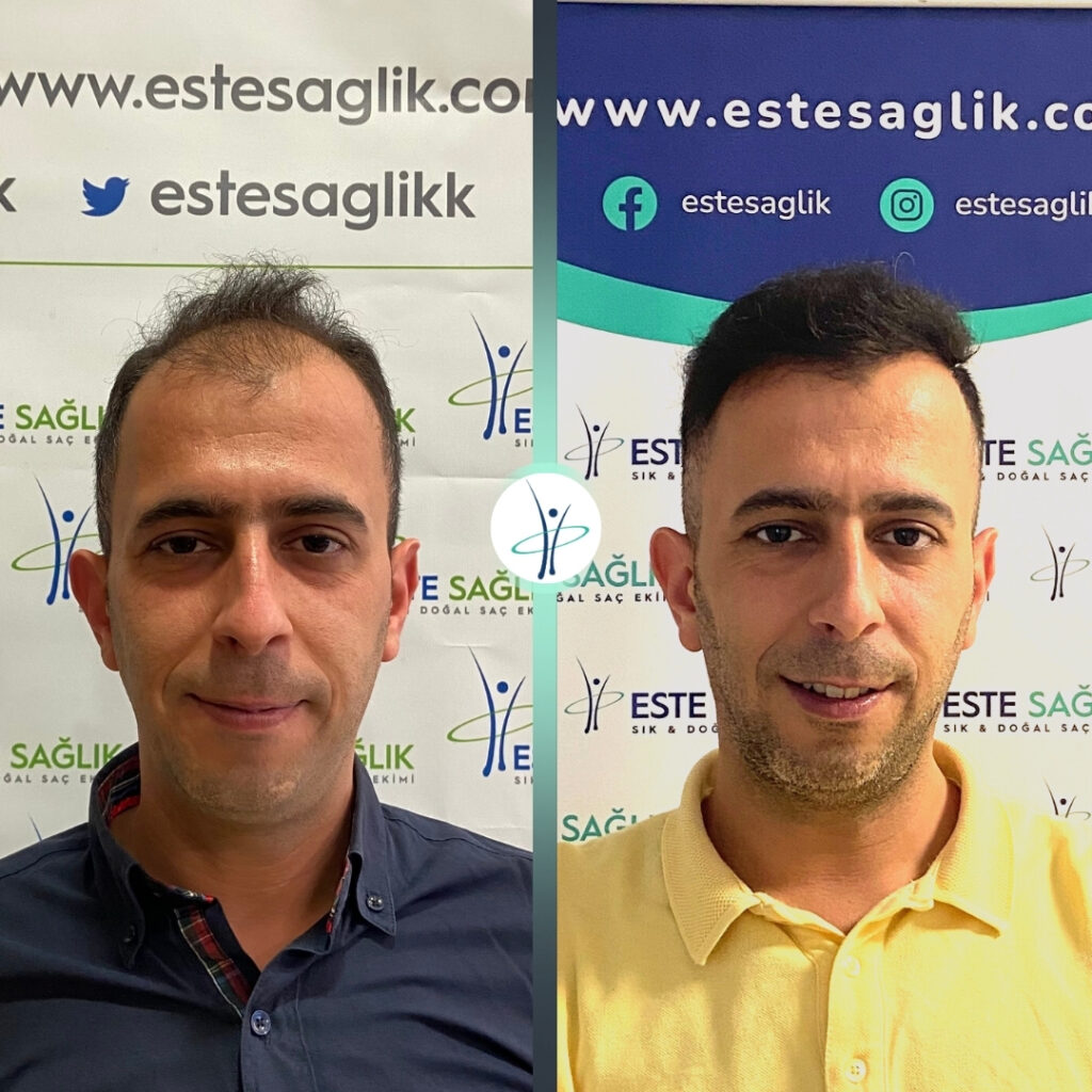 Este Sağlık 5